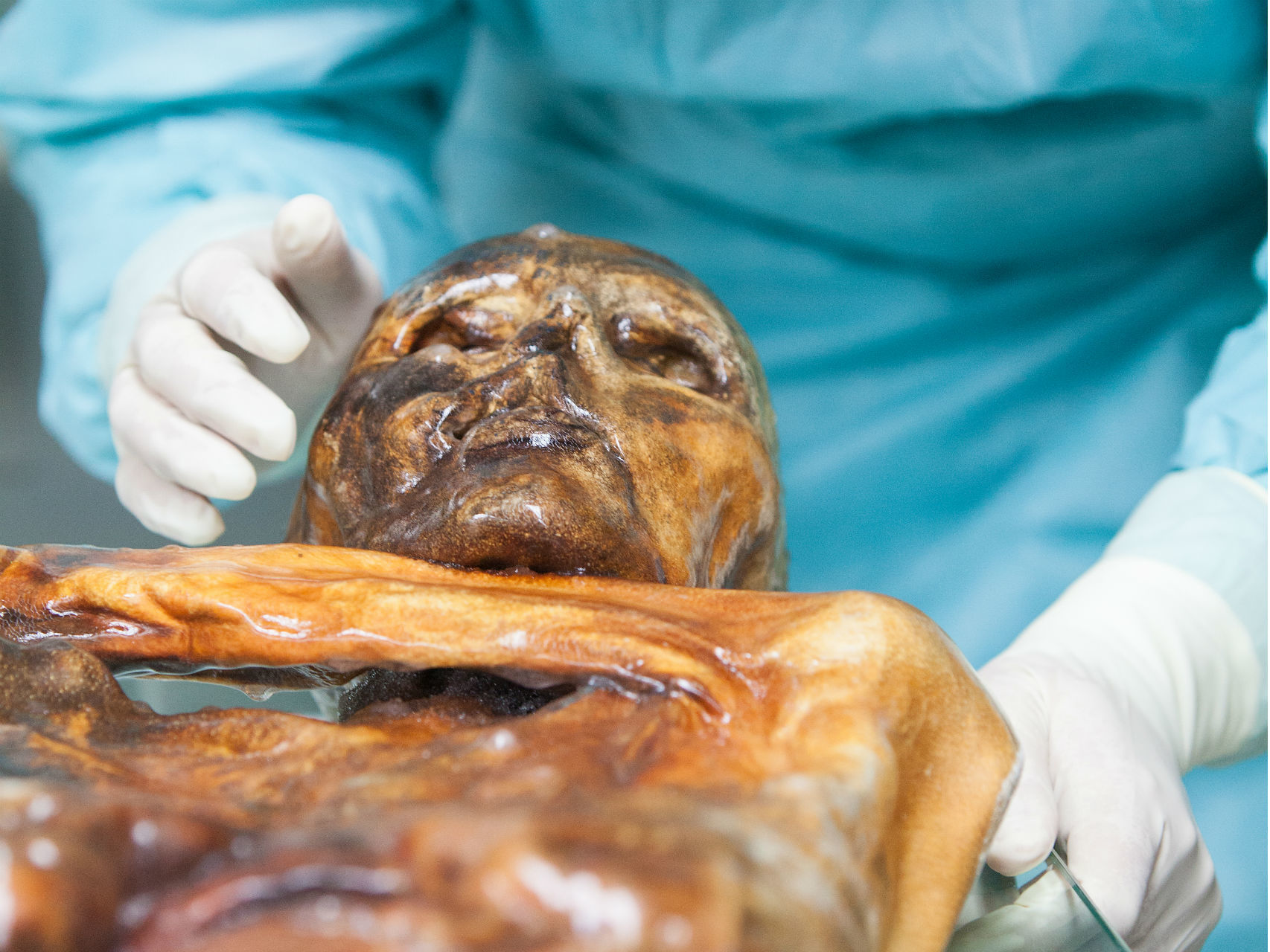 La momia de Ötzi, el hombre del hielo, también tiene valiosos microbios.