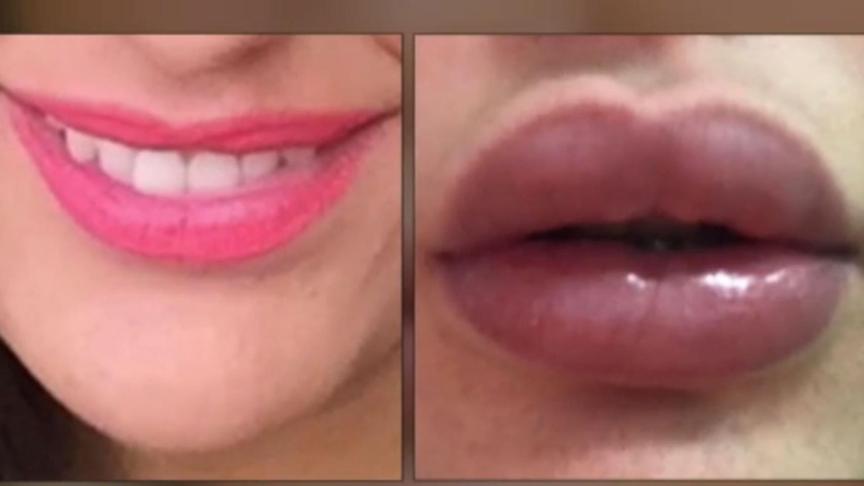 Gloria La M Dica Jubilada De Los Labios De Los Horrores Inyecciones Low Cost A Cientos De V Ctimas