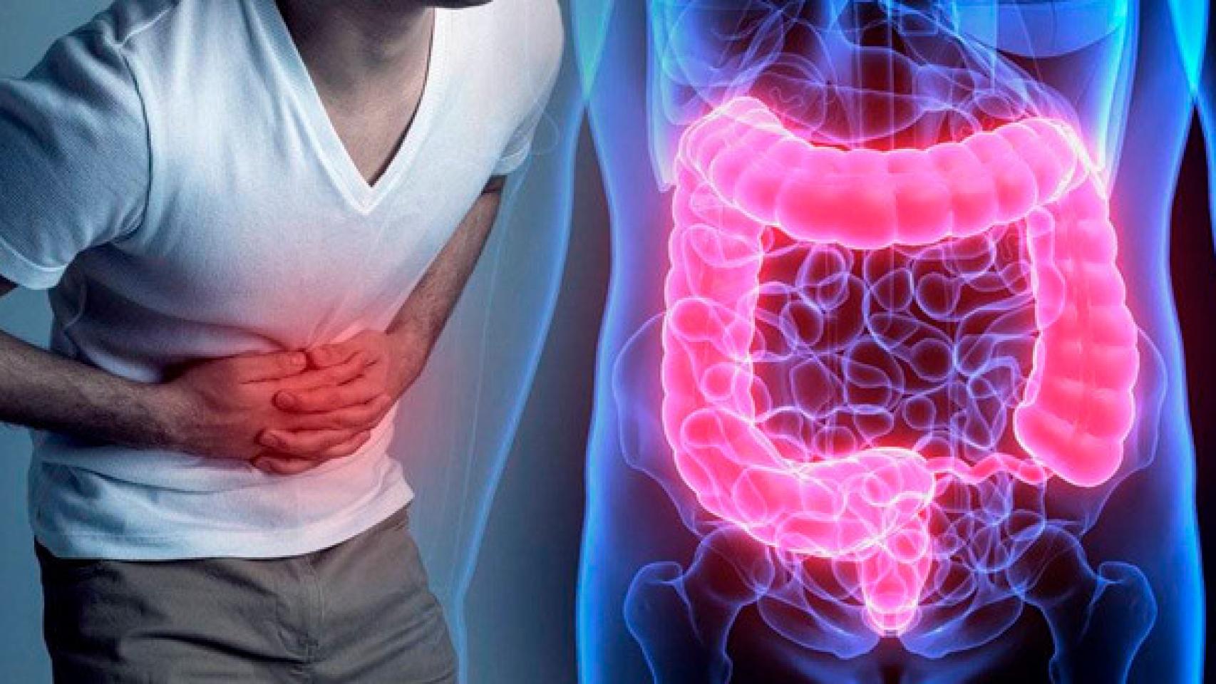 Estos Son Los Sencillos H Bitos Que Evitan La Inflamaci N Intestinal