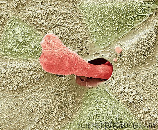 Ear wax secretion, SEM