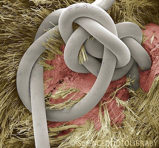 Sutured wound, SEM