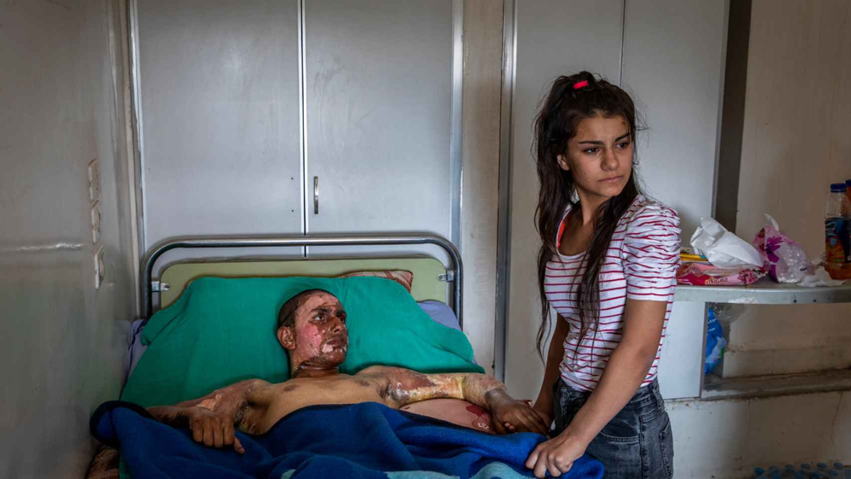 Ahmed Ibrahim de 18 años de las Fuerzas democráticas de Siria, gravemente quemado, recibe la visita de su novia en un hospital en Al-Hasakah (Siria), el 20 de octubre de 2019. © Ivor Prickett, Irlanda, para The New York Times