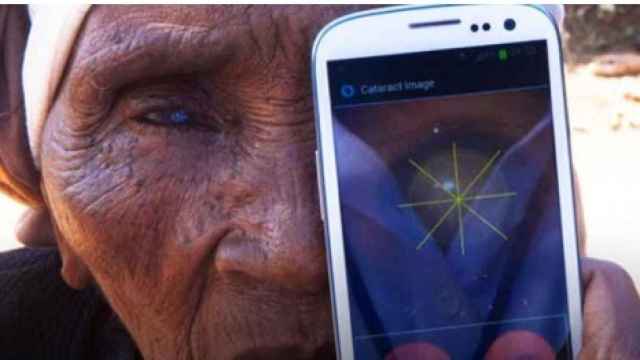 Peek, la aplicación capaz de diagnosticar problemas oculares