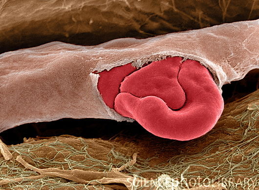 Ruptured capillary, SEM