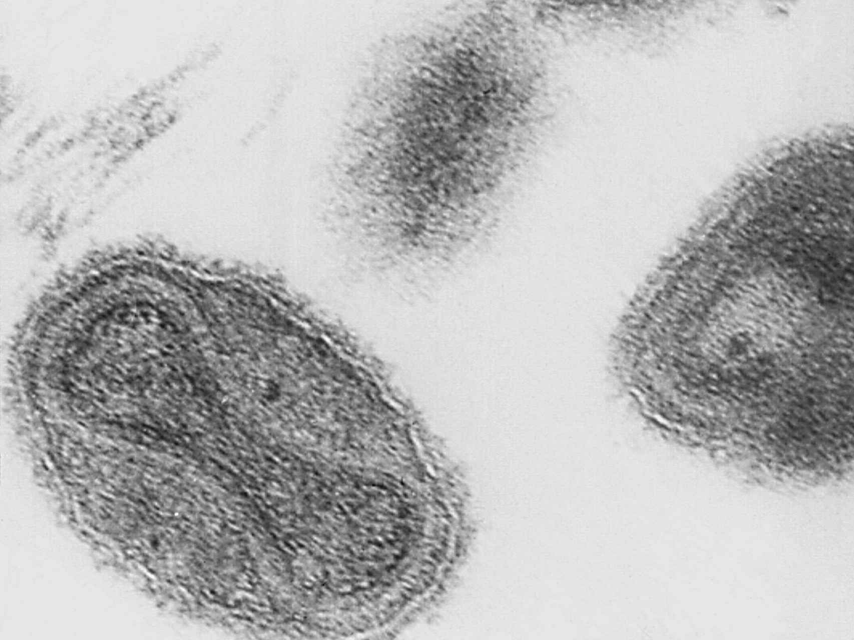 Micrografía electronica del virus de la viruela.