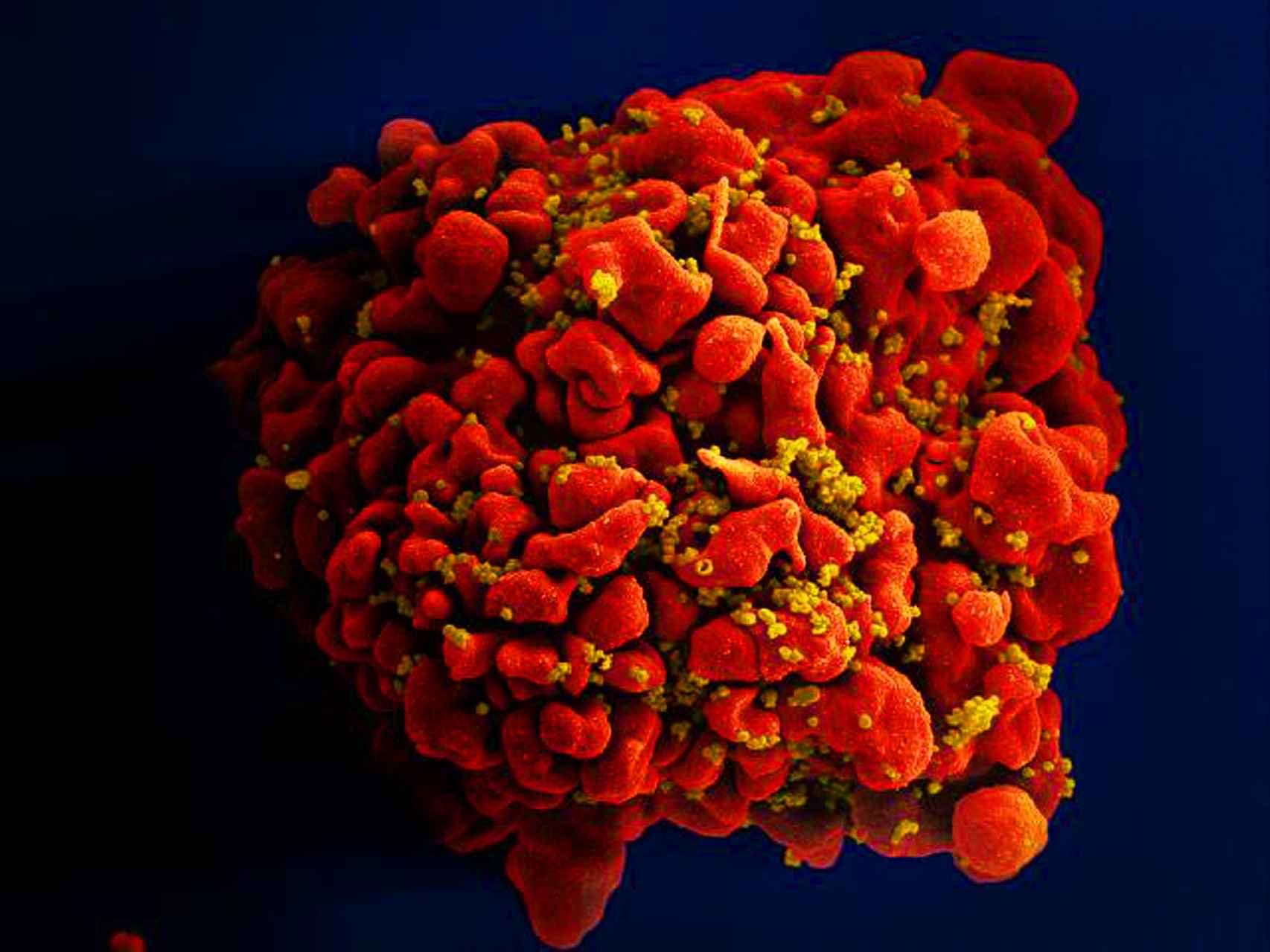 Una célula del sistema inmune invadida por VIH.