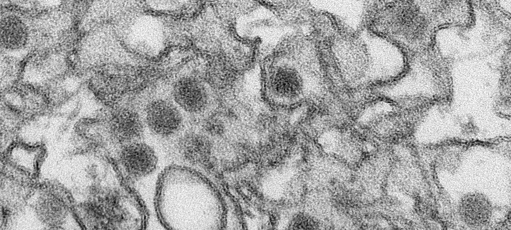 zika virus 1