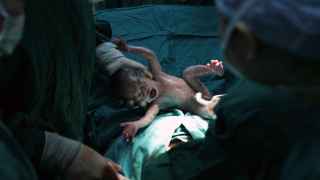 Un niño nacido por cesárea en un hospital chino.