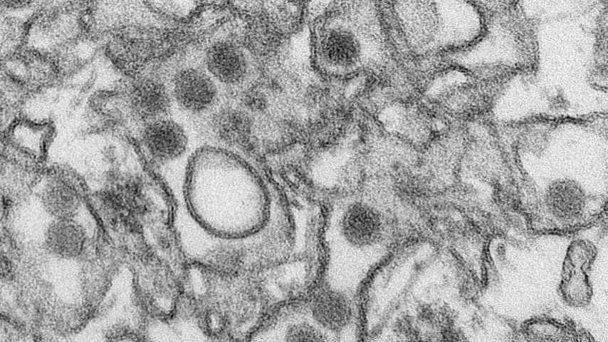 Imagen TEM del virus zika.