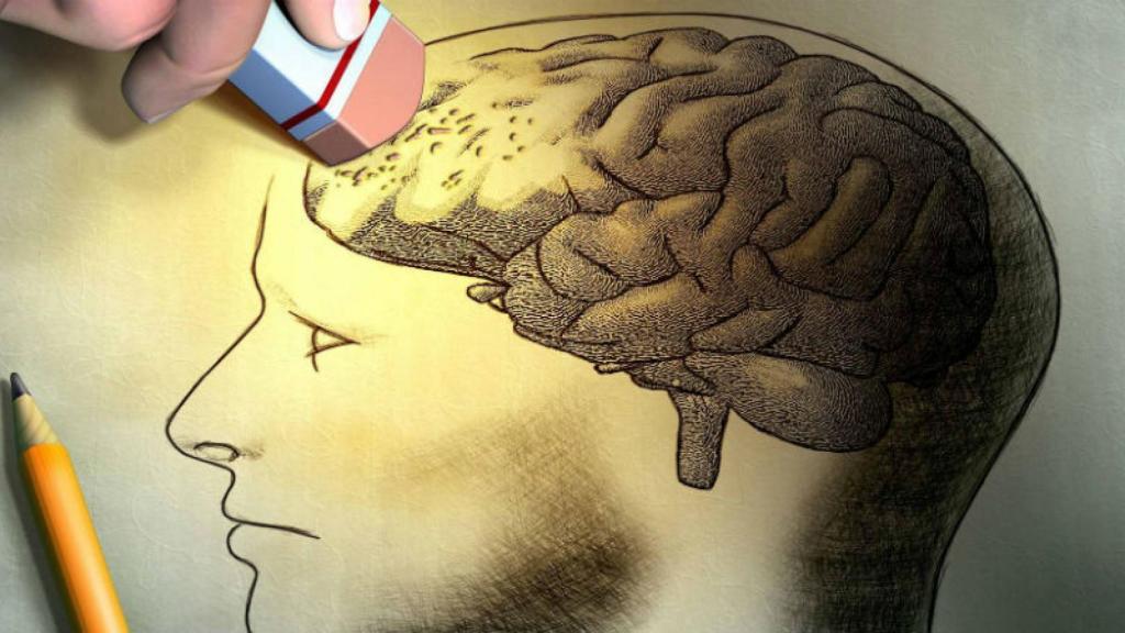 alzheimer