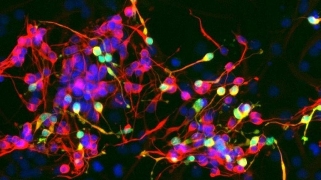 neuronas