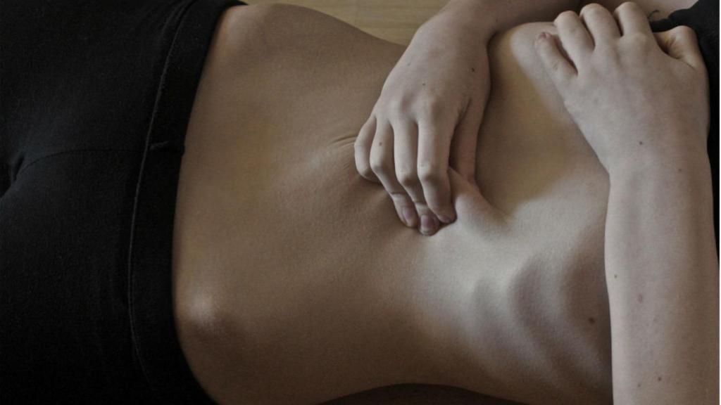 anorexia