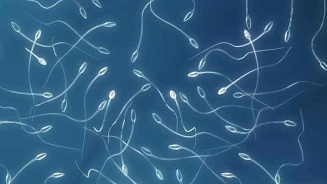 Representación de unos espermatozoides.