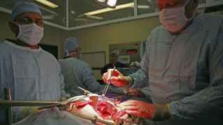 Dos cirujanos haciendo un trasplante de pulmón.