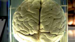 Cerebro de un chimpancé en el Museo de Ciencia de Londres.