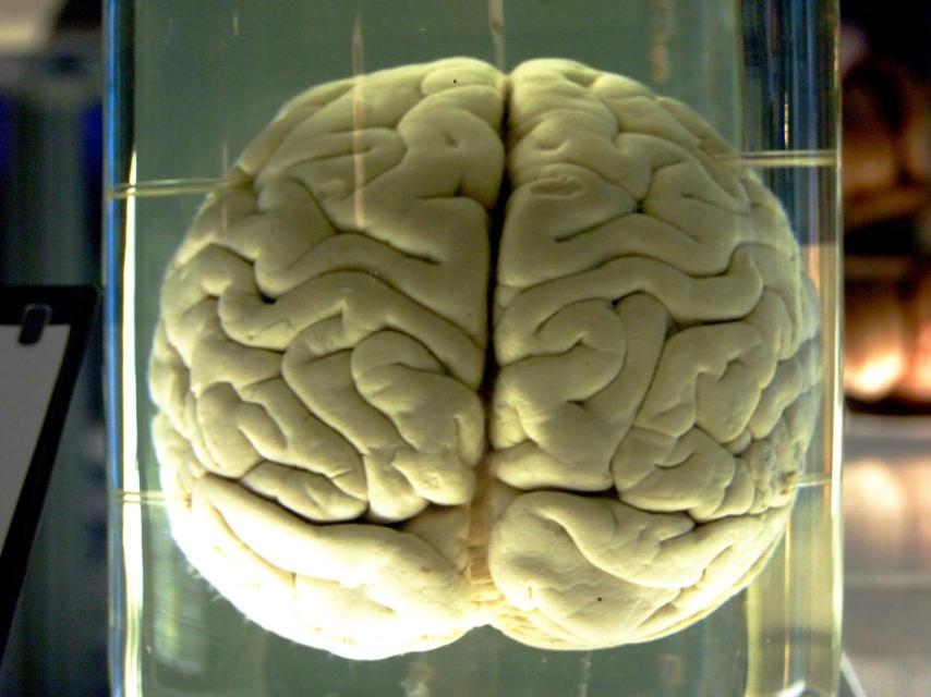 Cerebro de un chimpancé en el Museo de Ciencia de Londres.