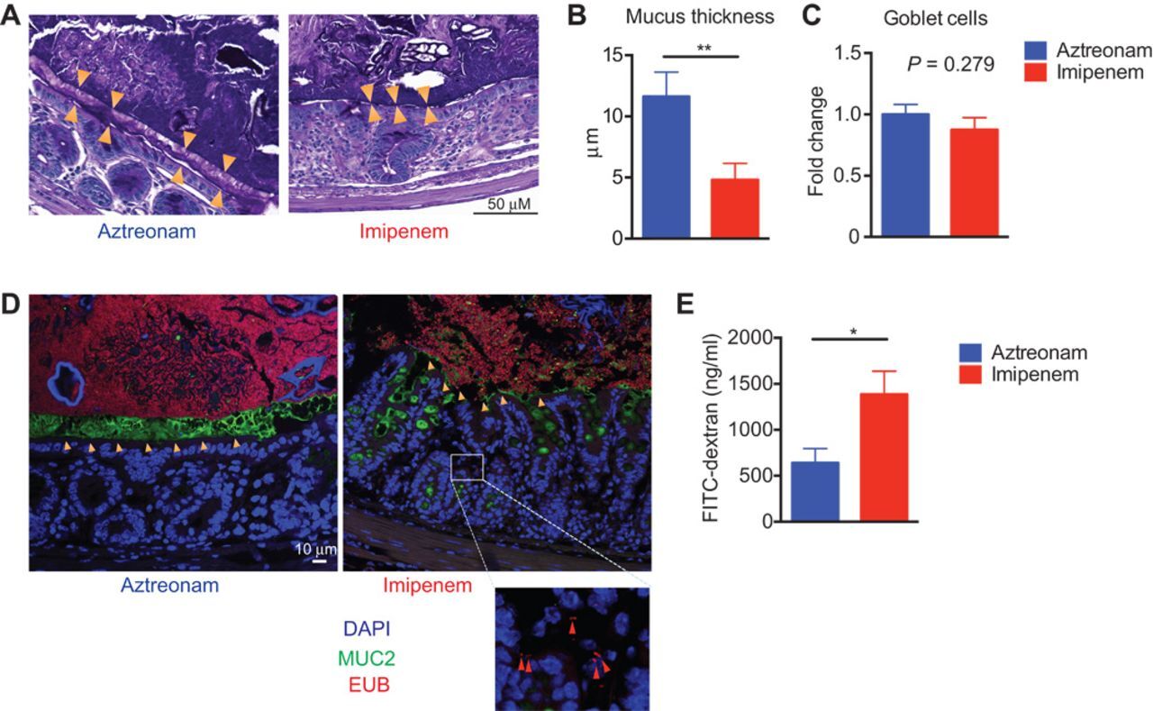 antibioticos_sistema_inmune