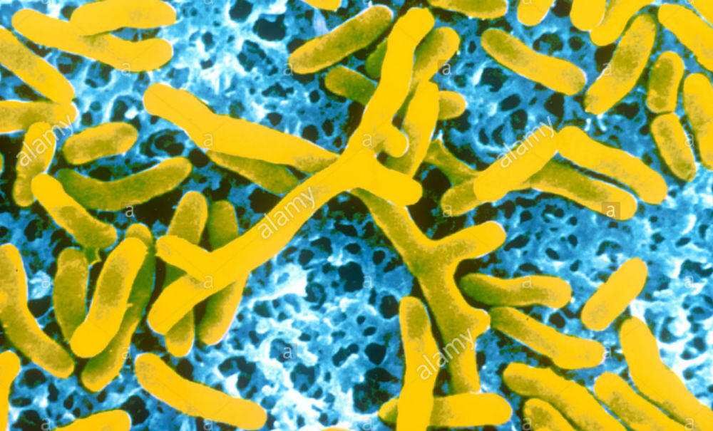 actinomyces_odontolyticus