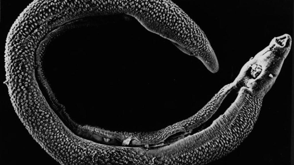 schistosoma_mansoni