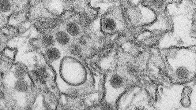 Imagen TEM del virus Zika.