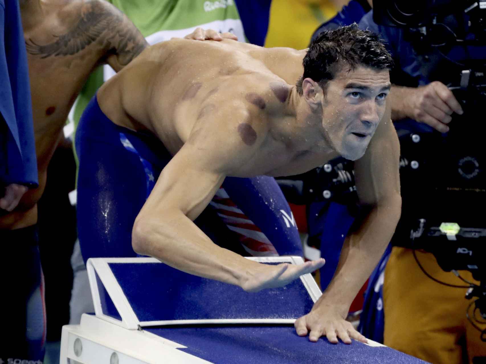 Los moratones de Michael Phelps, bien visibles.
