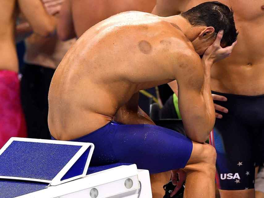 Las marcas de la piel de Phelps hicieron saltar todas las alarmas.