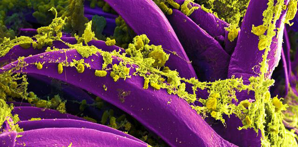 yersinia_pestis