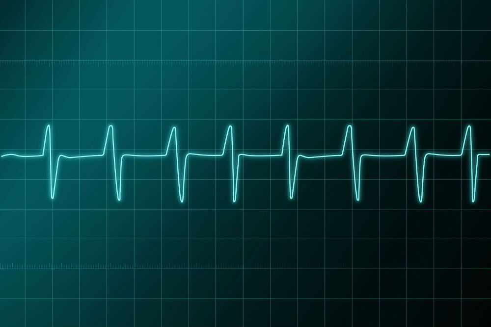 ritmo_cardiaco