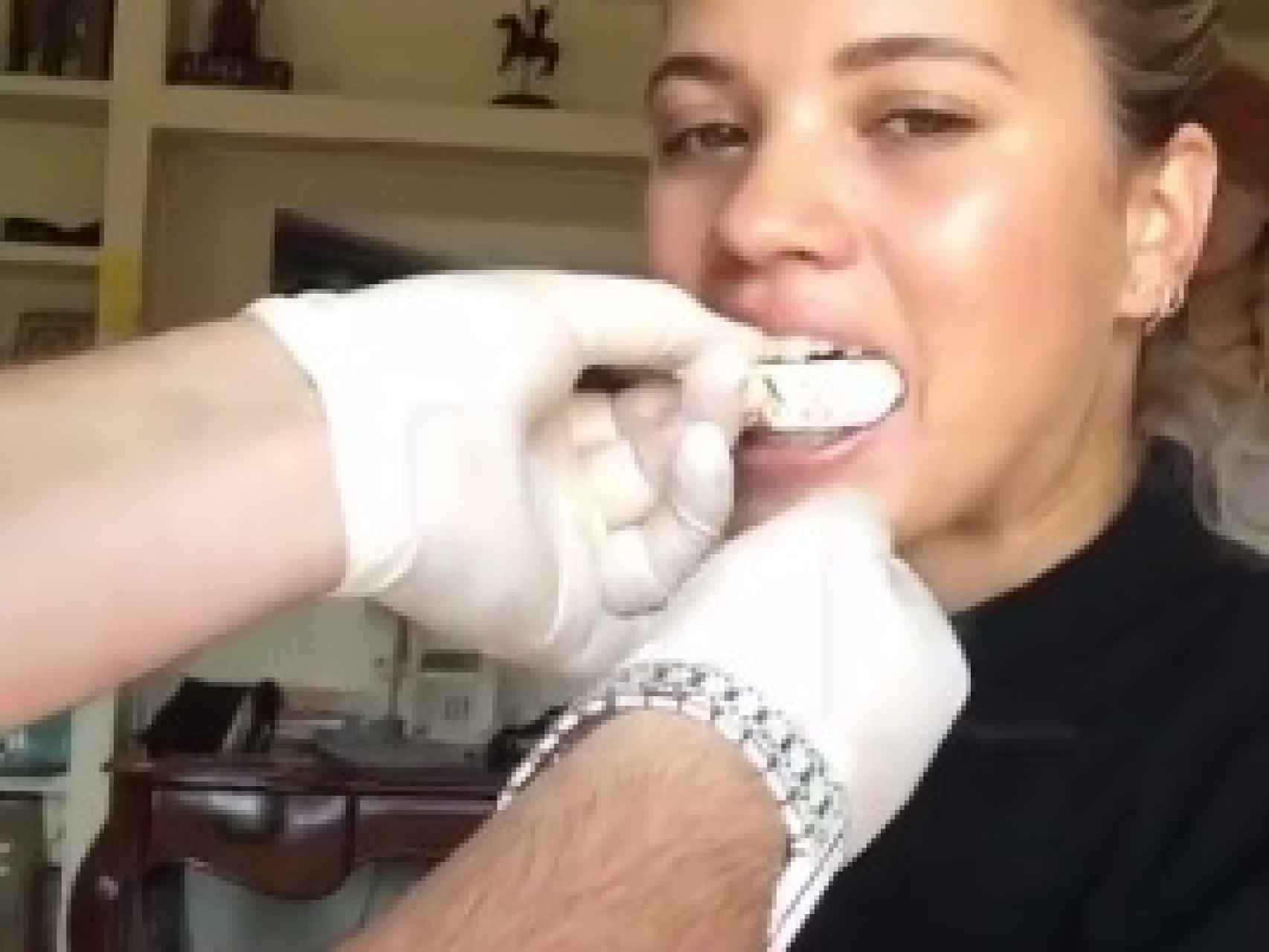 Sofia Richie preparándose para su nueva dentadura.
