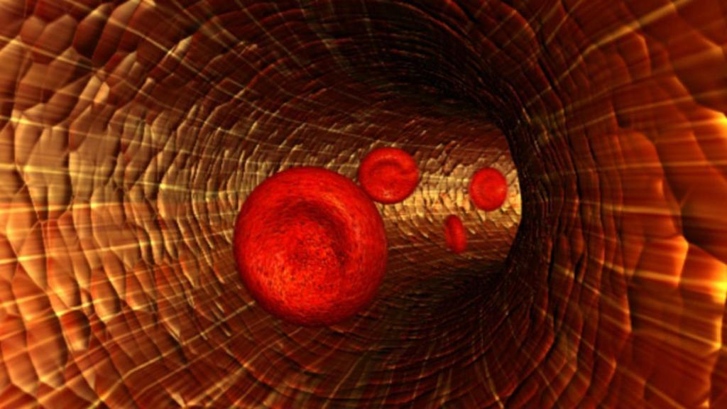 arteria