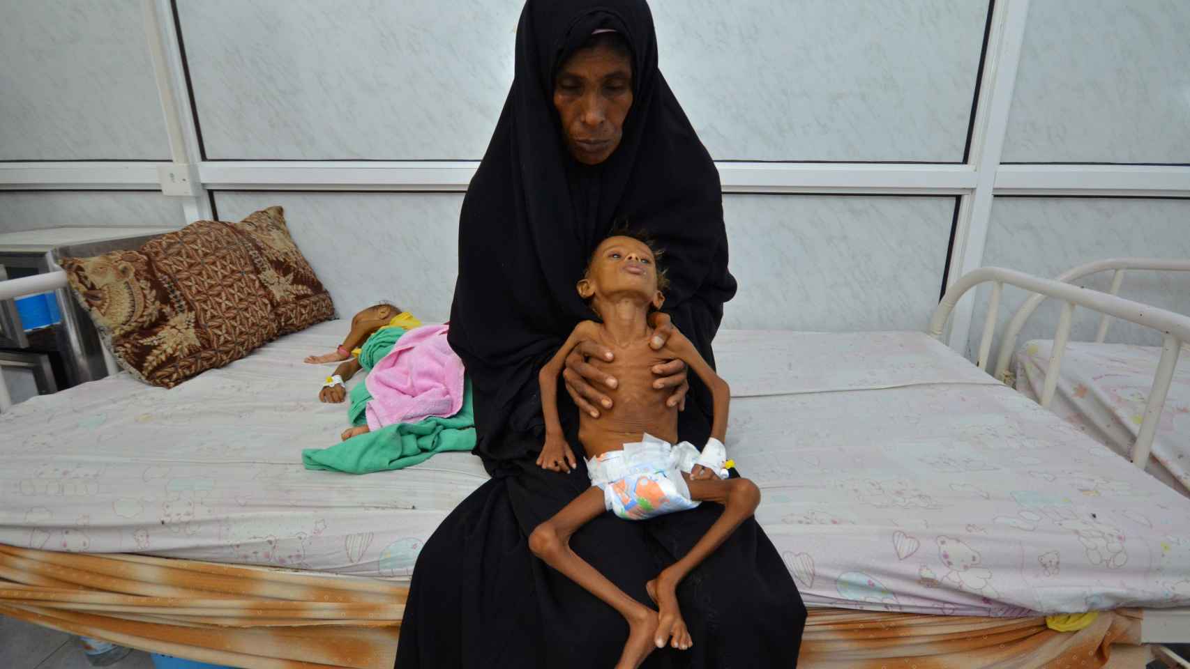 La madre de Salem sujeta a su pequeño de seis años en el hospital donde trata de recuperarse de la malnutrición.