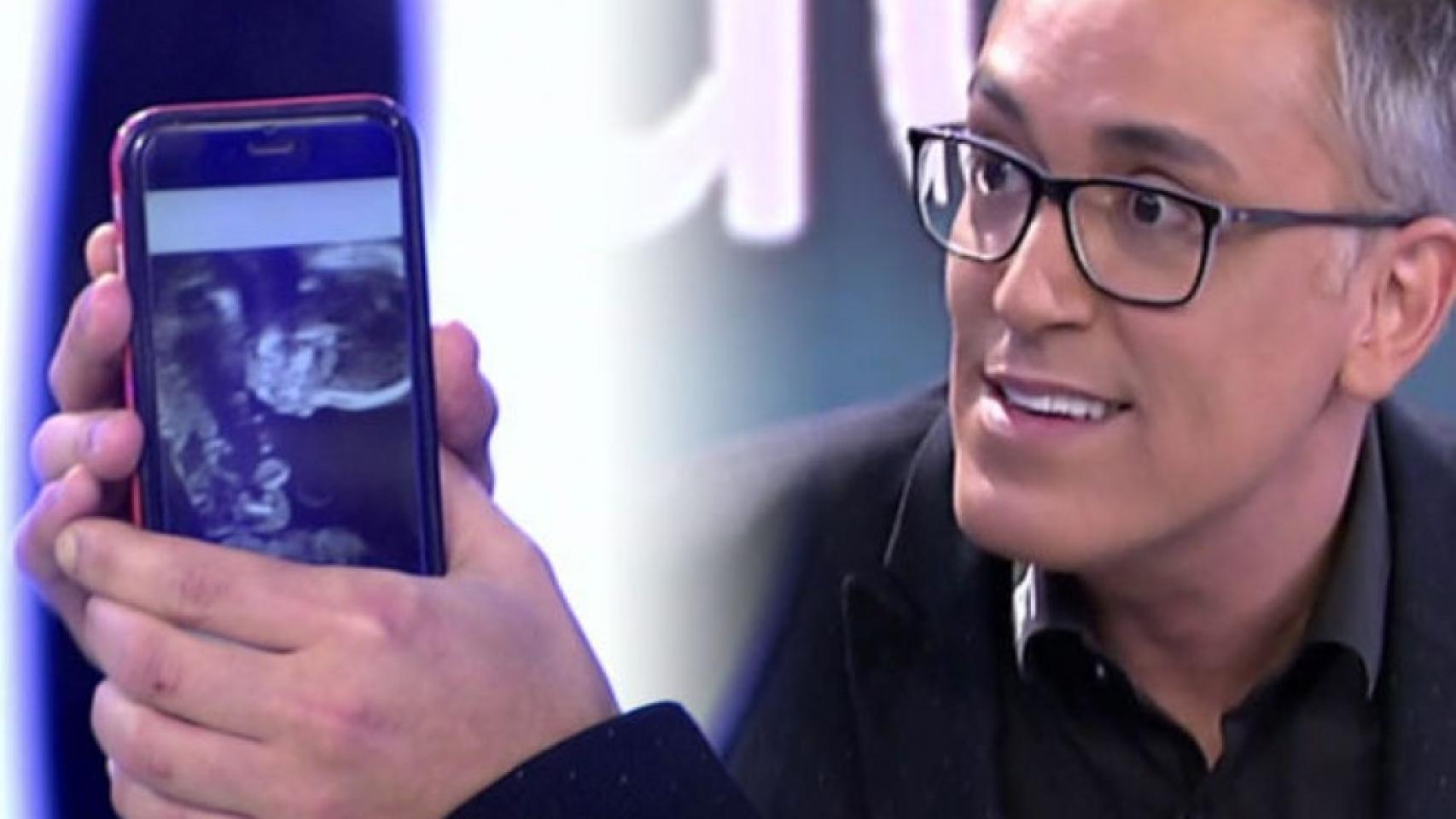 Kiko Hernández.