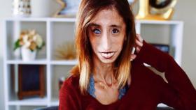 El mensaje de Lizzie Velasquez ha llegado a miles de personas.