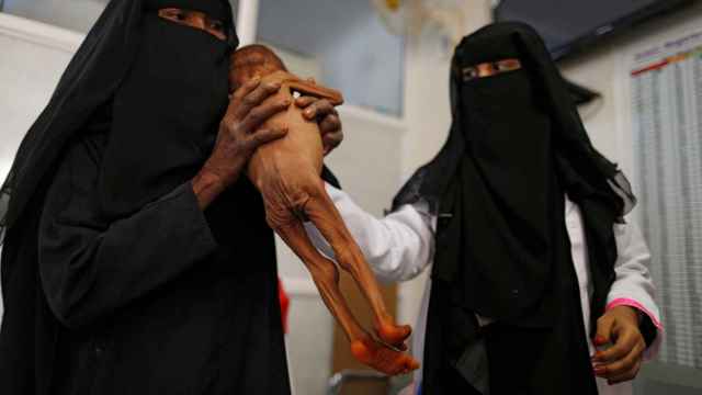 Una madre yemení toma en brazos a su hijo niño desnutrido en una clínica.
