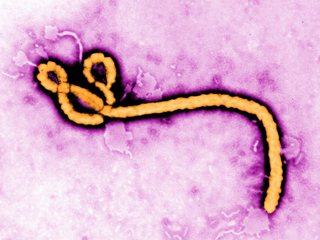 ebola