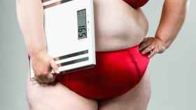 Mujer obesa.