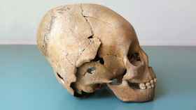 La práctica de la unión de las cabezas de los niños para alargar el cráneo se cree que se originó entre los hunos nómadas.