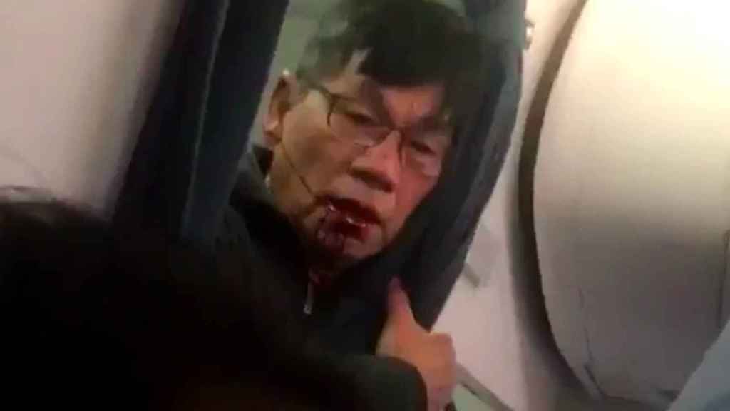 Así quedó David Dao tras ser arrastrado por el avión de United Airlines.