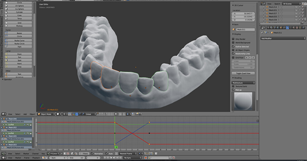 ortodoncia impresion 3d 5