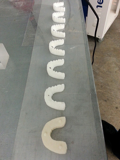 ortodoncia impresion 3d 4