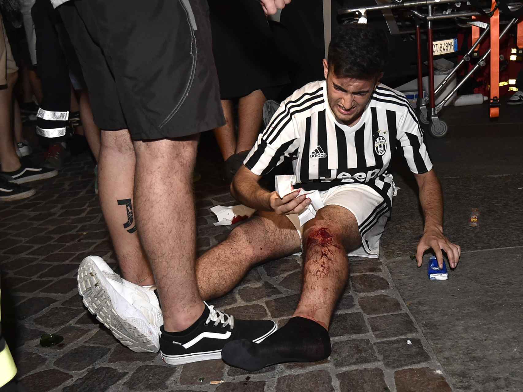 Un joven con la elástica del equipo italiano se duele de las heridas. / Reuters