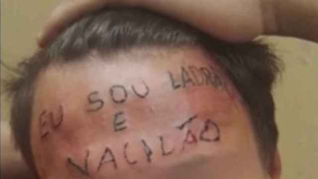 La frente tatuada del joven brasileño.