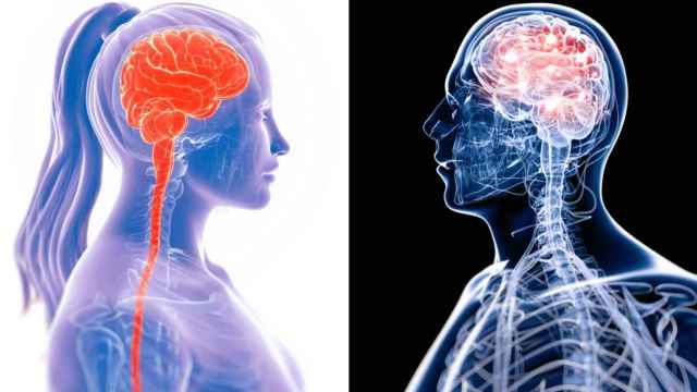 Representación gráfica del cerebro de una mujer y un hombre.
