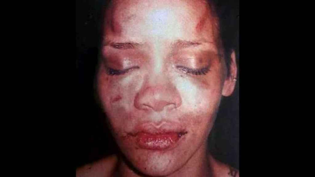 Rihanna tras la agresión, en una Imagen de archivo de la policía de Los Ángeles