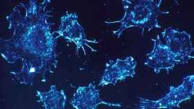 Células cancerígenas vistas con un microscopio.