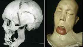 Cráneo y molde en yeso del rostro de John Brogan.
