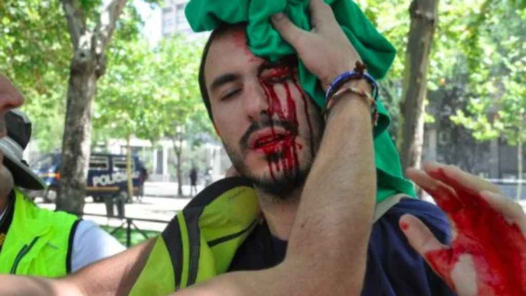 Este chico no fue herido el 1-0 como se difundió, sino durante las protestas de mineros en Madrid en 2012.