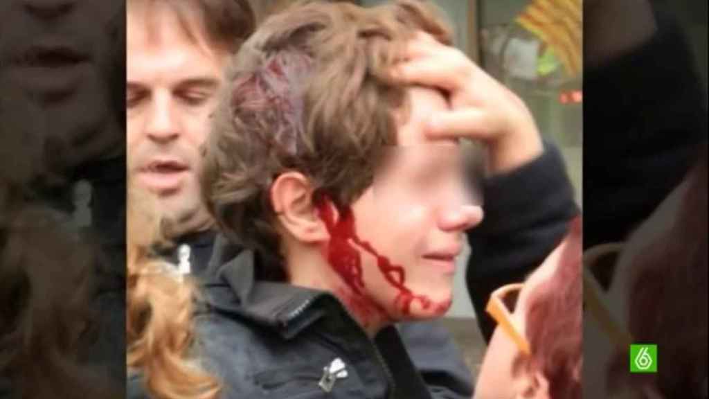 Menor herido durante la huelga del 14-N de 2012.