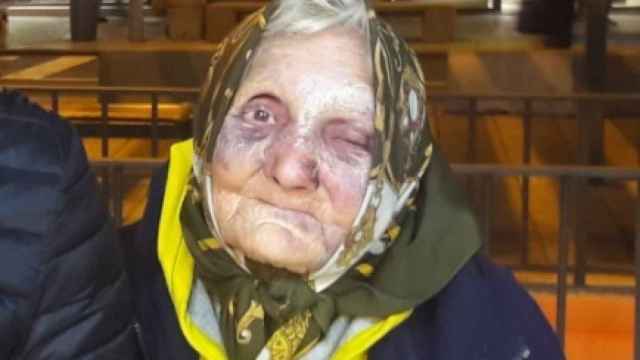 La anciana pernocta habitualmente en la calle Fuencarral de Madrid.