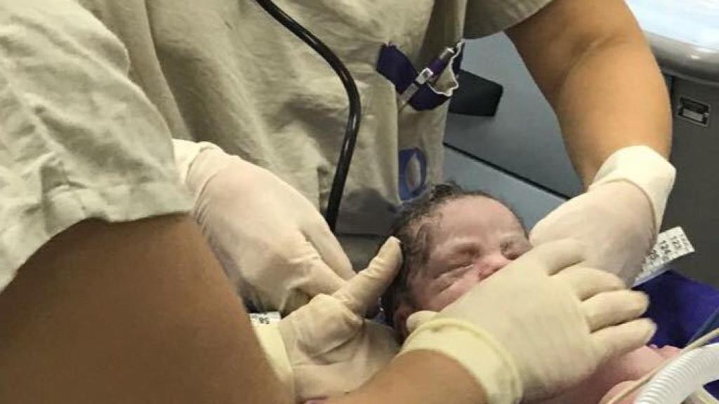 El bebé gestado en el útero de una mujer fallecida.